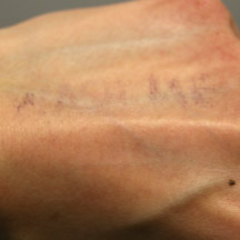 Hand After