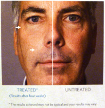 NuSkin ageLOC Galvanic Spa System II