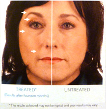 NuSkin ageLOC Galvanic Spa System II