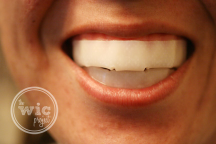 Rembrandt Whitening Strips