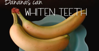 Bananas Can Whiten Teeth
