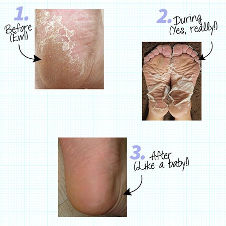 Baby Foot Pictures